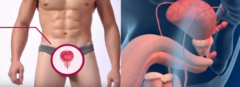 Prostatita la barbati, recunoscuta dupa anumite semne